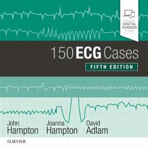 150 ECG Cases 5e