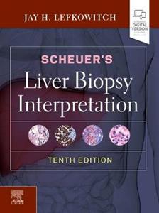 Scheuers Liver Biopsy Interpretation 10E