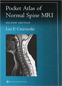 Pocket Atlas of Spinal MRI (Radiology Pocket Atlas Series)