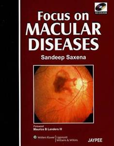 FOCUS MACULAR DISEASES (BOOK+DVD/NTSC)