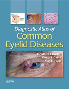 Diagnostic Atlas of Common Eyelid Diseases