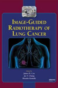 Image-Guided Radiotherapy of Lung Cancer