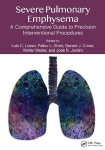 Severe Pulmonary Emphysema:: A Comprehensive Guide to Precision Interventional Procedures