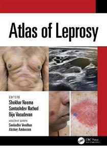 Atlas of Leprosy