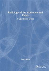 Radiology of the Abdomen and Pelvis: A Case-Based Guide