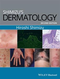 Shimizu's Dermatology 2nd edition