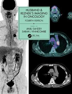 Husband amp; Reznek's Imaging in Oncology