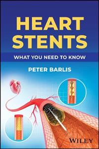 Heart Stents: What You Need to Know