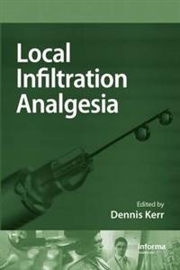 Local Infiltration Analgesia