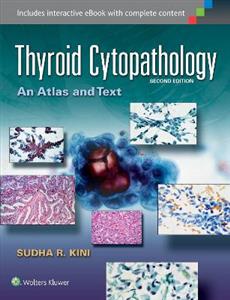 Thyroid Cytopathology