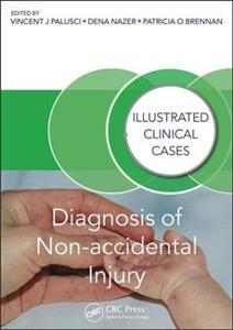 Diagnosis of Non-accidental Injury