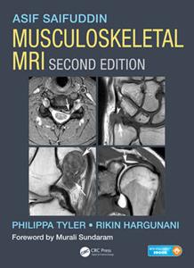 Musculoskeletal MRI 2nd edition