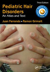 Pediatric Hair Disorders