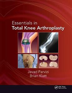 Essentials in Total Knee Arthroplasty