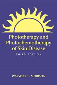 Phototherapy and Photochemotherapy for Skin Disease