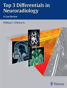 Top 3 Differentials in Neuroradiology: A Case Review