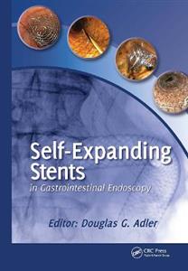 Self-Expanding Stents in Gastrointestinal Endoscopy