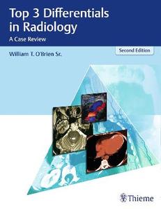  Top 3 Differentials in Radiology: A Case Review