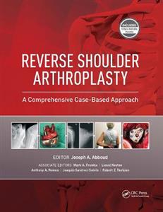 Reverse Shoulder Arthroplasty