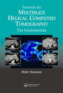 Protocols for Multislice Helical Computed Tomography