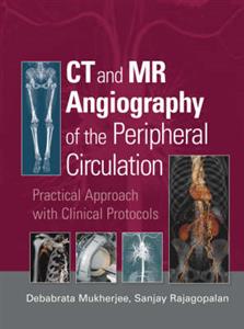 CT and MR Angiography of the Peripheral Circulation