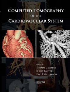 Computed Tomography of the Cardiovascular System