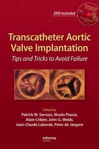 Transcatheter Aortic Valve Implantation