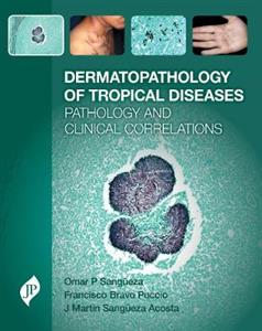 Dermatopathology of Tropical Diseases