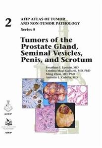 Tumors of the Prostate Gland, Seminal Vesicles, Penis, and Scrotum