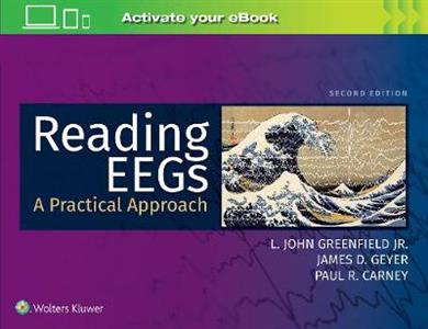 Reading EEGs: A Practical Approach