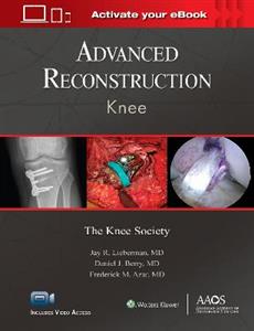 Advanced Reconstruction: Knee: Print + Ebook with Multimedia (AAOS - American Academy of Orthopaedic Surgeons)