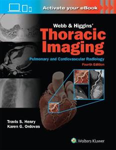 Thoracic Imaging 4e