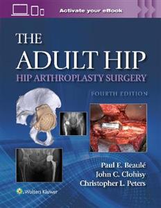  The Adult Hip: Hip Arthroplasty Surgery Print + eBook with Multimedia