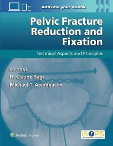  Pelvic Fracture Reduction and Fixation: Technical Aspects and Principles