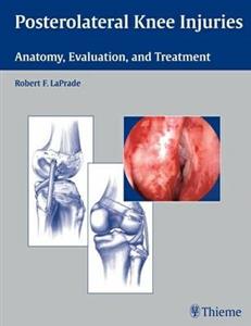 Posterolateral Knee Injuries: Anatomy, Evaluation, and Treatment