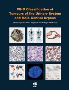 WHO classification of tumours of the urinary system and male genital organs
