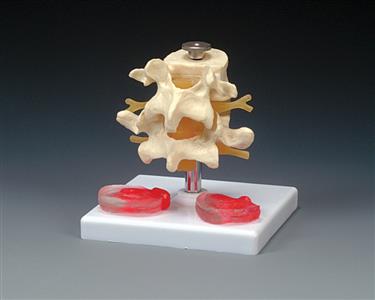 Budget Lumbar Vertebrae With Interchangeable Discs